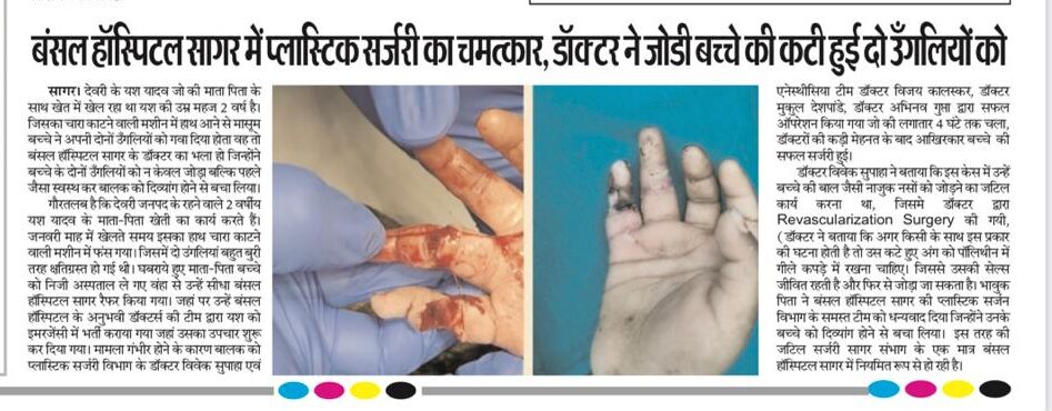 Complex finger revascularization case — media coverage