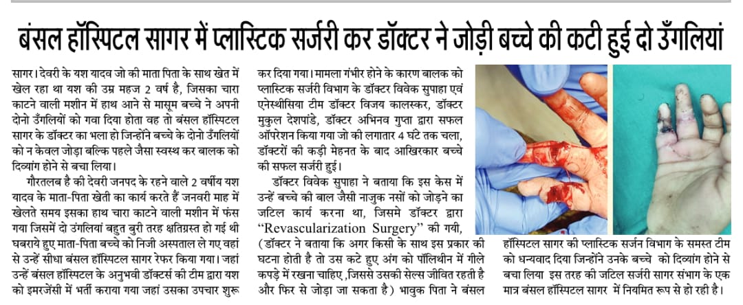 Complex finger revascularization surgery — media coverage